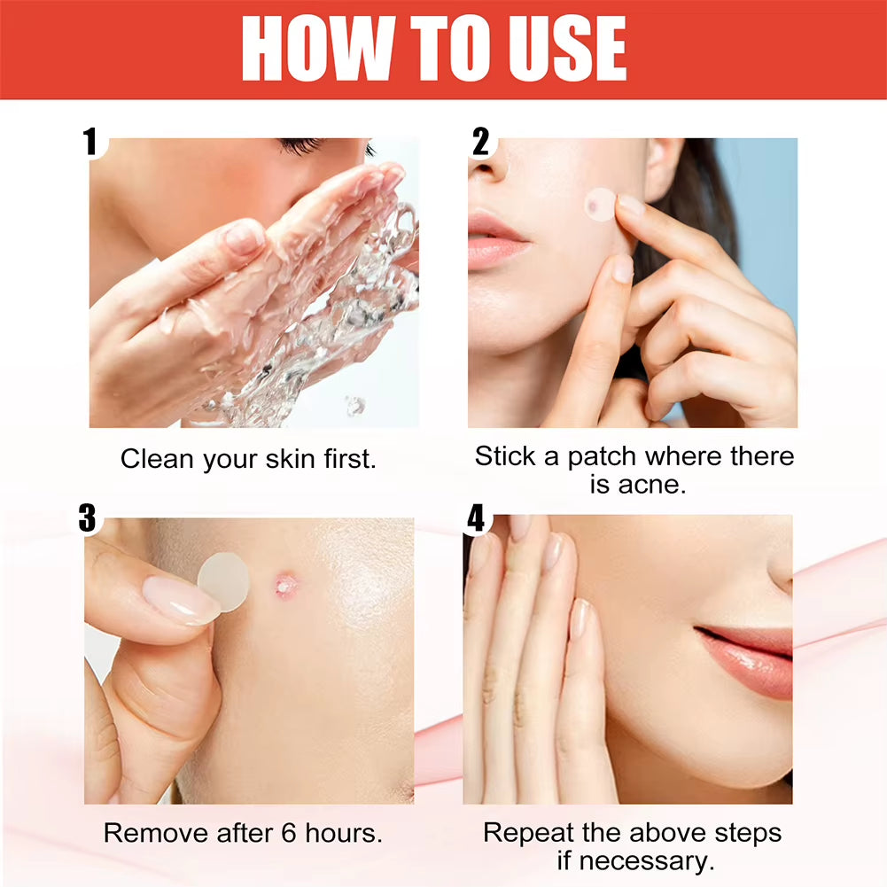 240Pcs New High-End Pimple Patch Acne Patches Heart/Star Shape Acne Dots Patches Moisturizes for Covering Zits and Blemishes