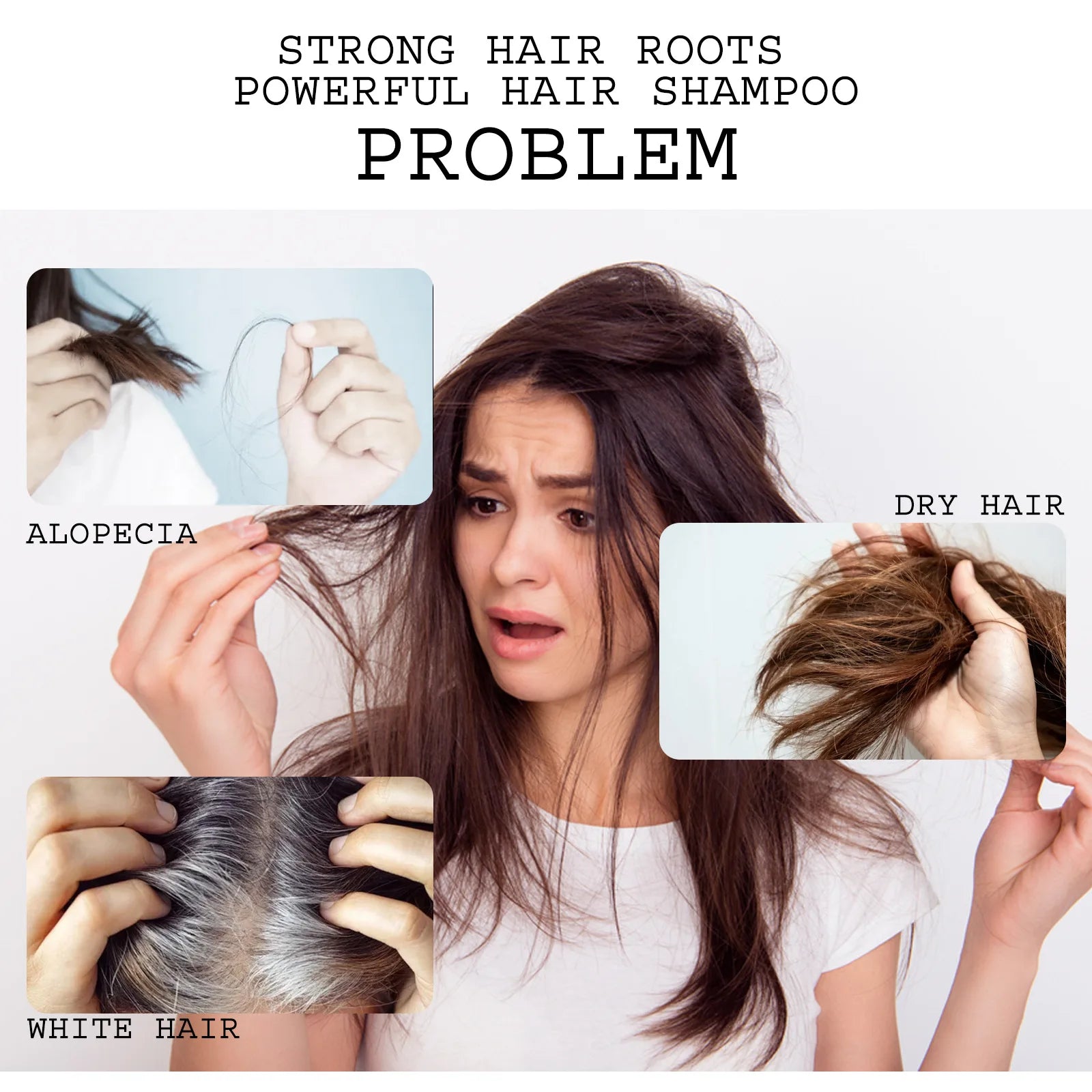 Hair Regrowth Shampoo Prevent Baldness Repair Damage anti Dandruff Itching Oil Control Scalp Nourish Hair Loss Treatment Shampoo